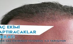 İzmir Saç Ekiminde İstanbul İle Yarışıyor