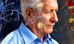“Ortalama ömür uzadığı için Alzheimer olma riski arttı”