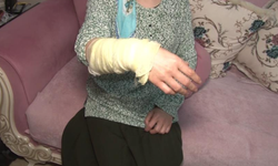 Boşanmak istemeyen  koca, kezzaplı saldırı düzenledi