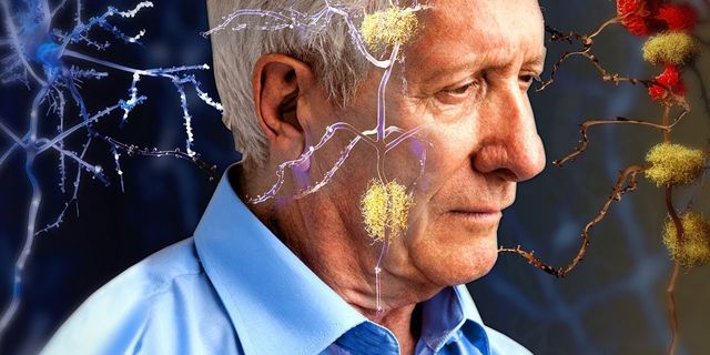 “Ortalama ömür uzadığı için Alzheimer olma riski arttı”
