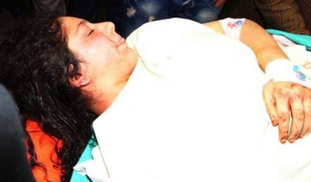 Hamile kadın bileği kesilerek gasp edildi