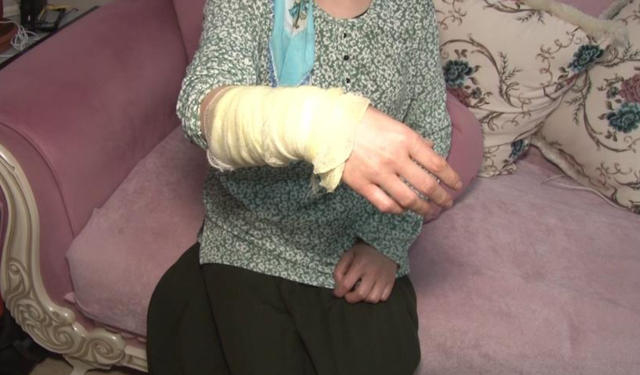 Boşanmak istemeyen  koca, kezzaplı saldırı düzenledi
